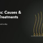 Hair loss causes and proven treatments guide by Biohacademy